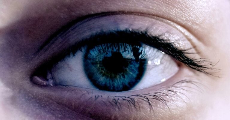 dry-eyes