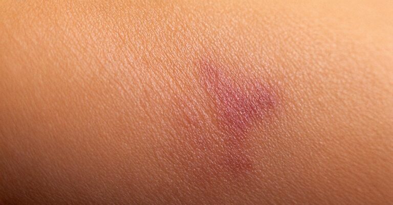 irritated-skin