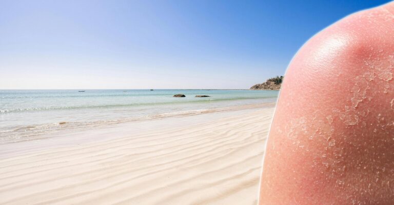 sun-damage