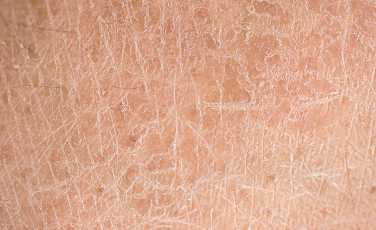 skin-conditions-thumb